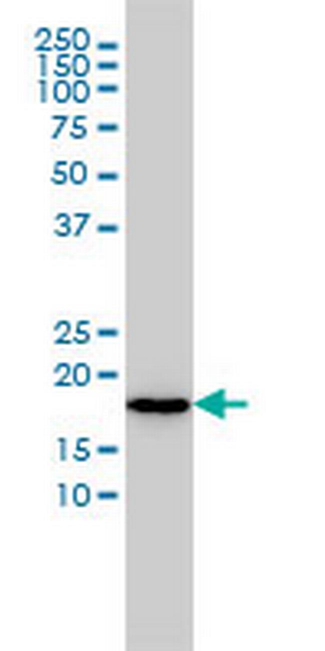 NAT5 Antibody in Western Blot (WB)