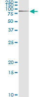 RNF12 Antibody in Immunoprecipitation (IP)