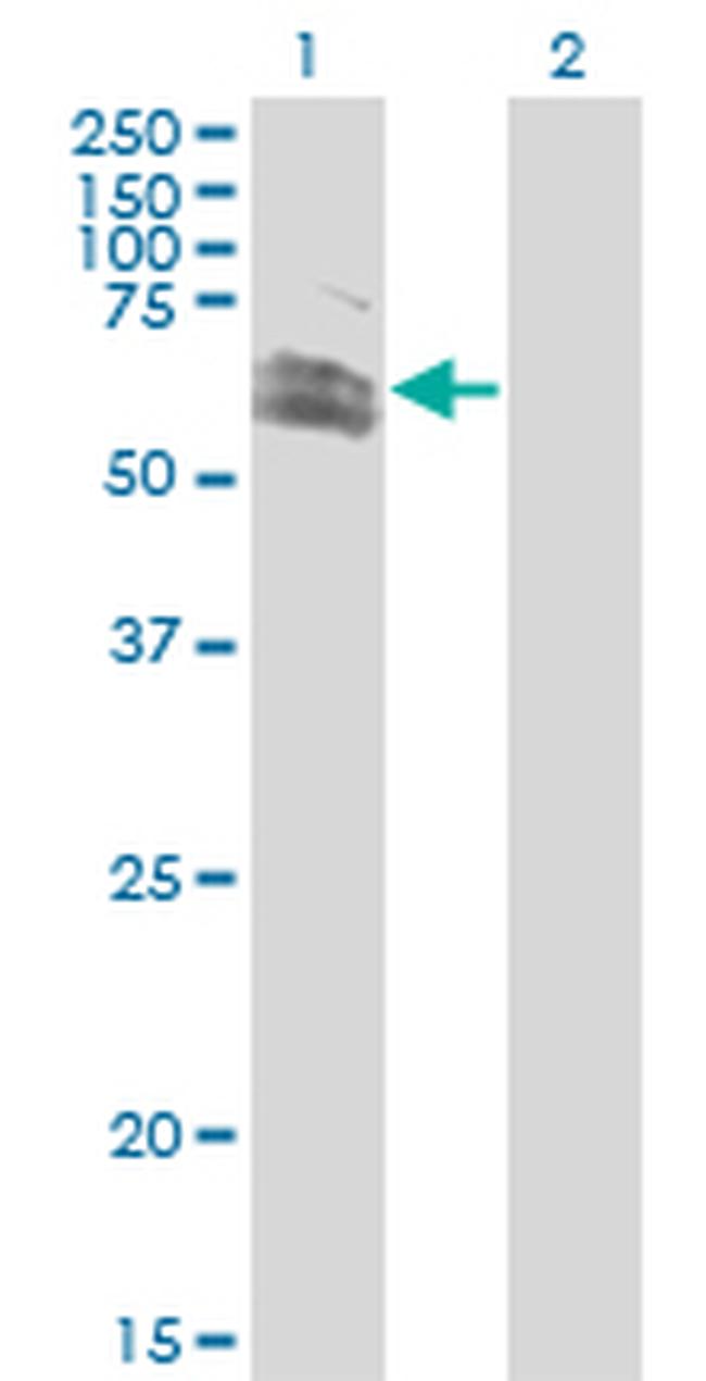 RNF12 Antibody in Western Blot (WB)