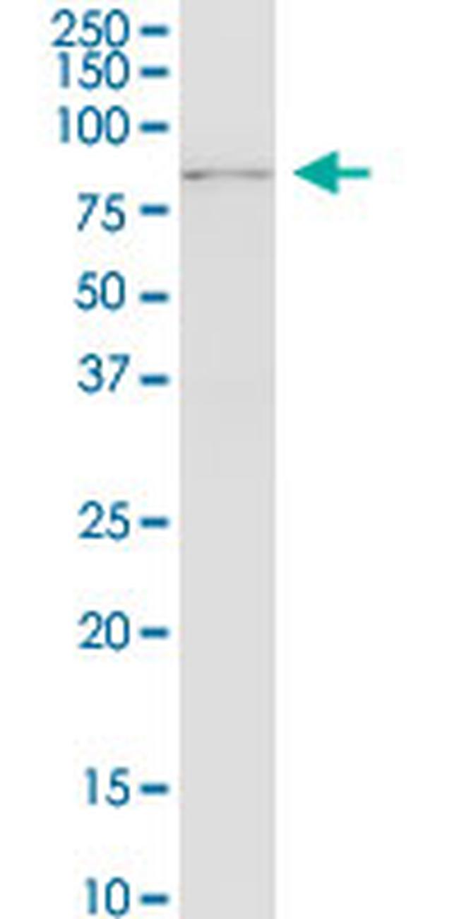 RNF12 Antibody in Western Blot (WB)