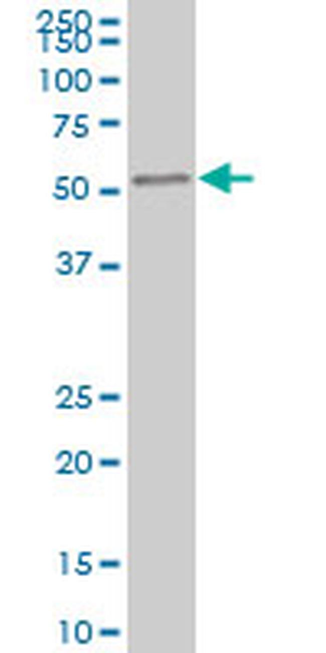 IRAK4 Antibody in Western Blot (WB)