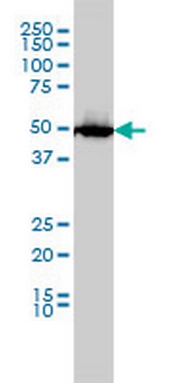 SLC45A2 Antibody in Western Blot (WB)