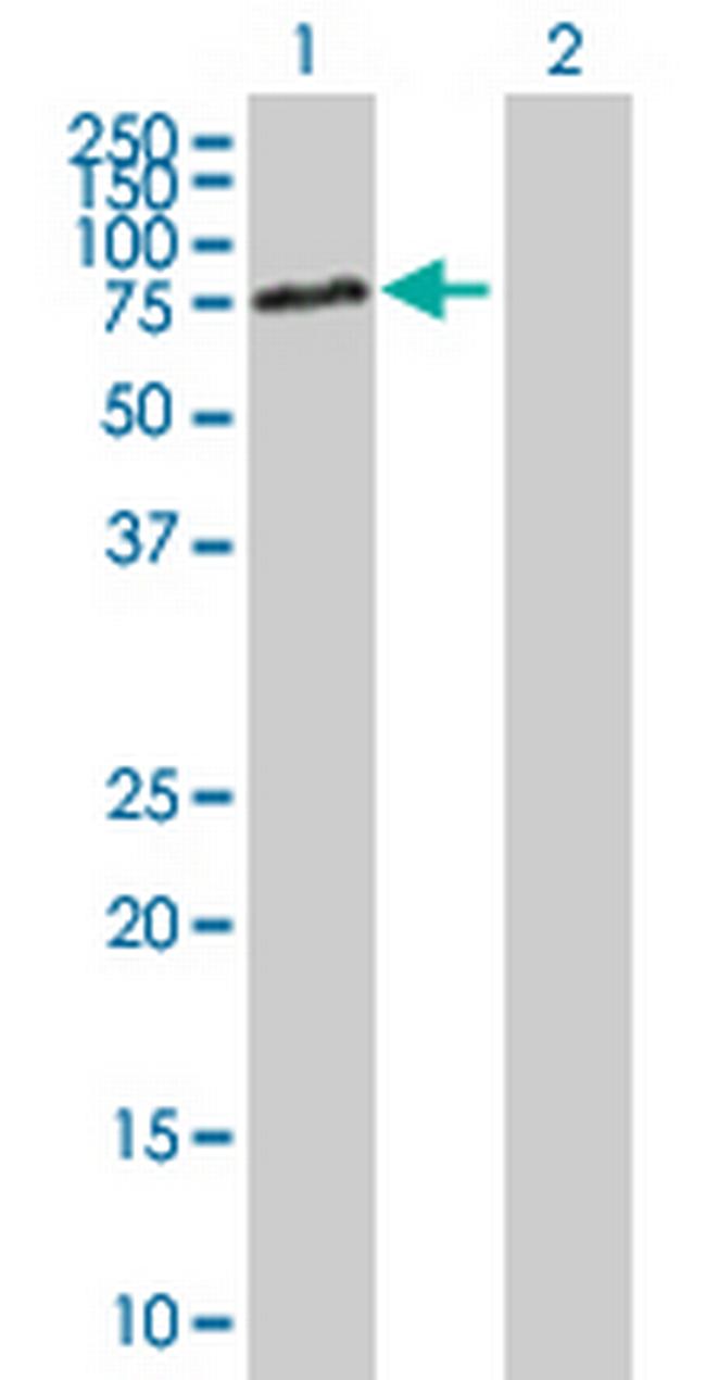 DBR1 Antibody in Western Blot (WB)