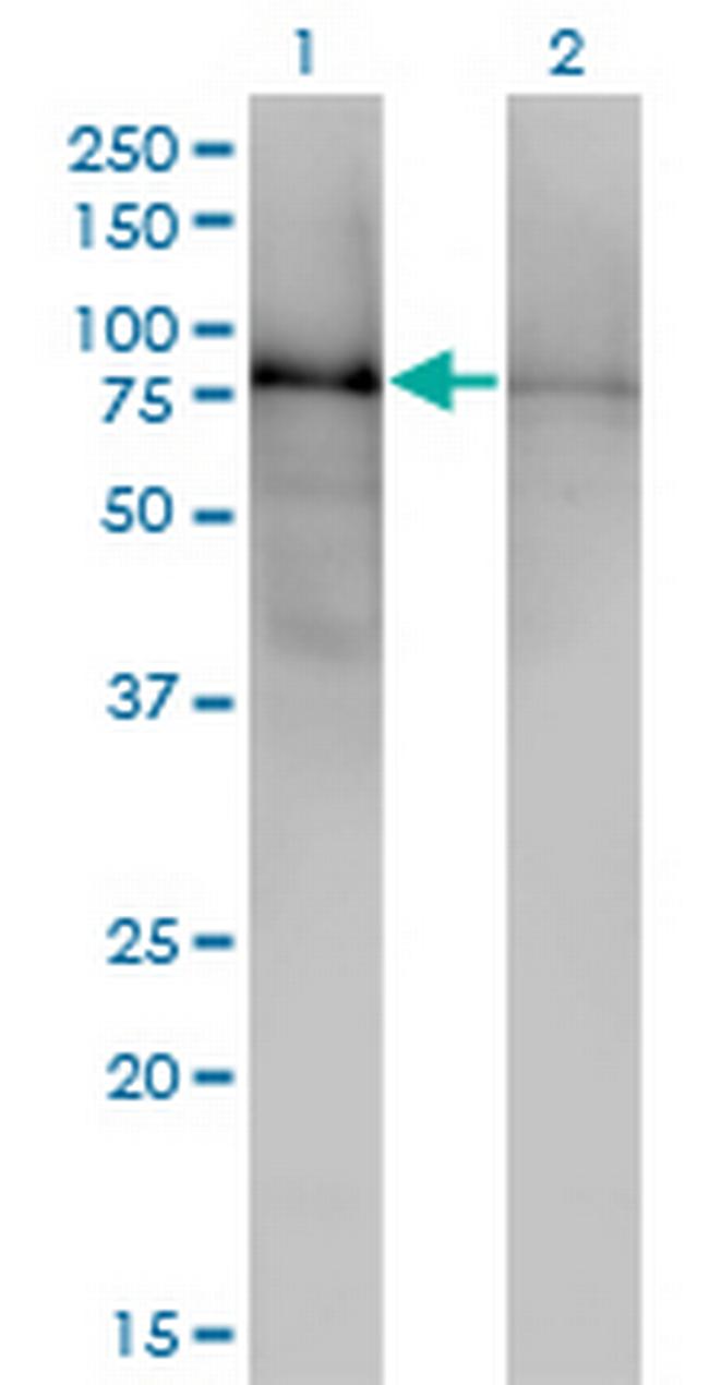 DBR1 Antibody in Western Blot (WB)