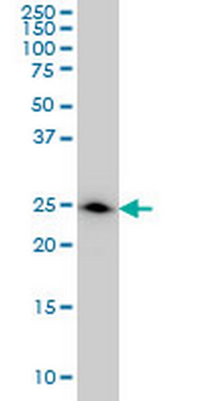 DCXR Antibody in Western Blot (WB)