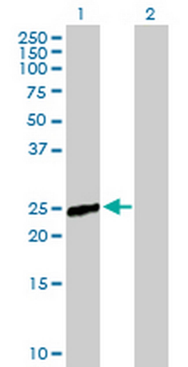 RAB9B Antibody in Western Blot (WB)