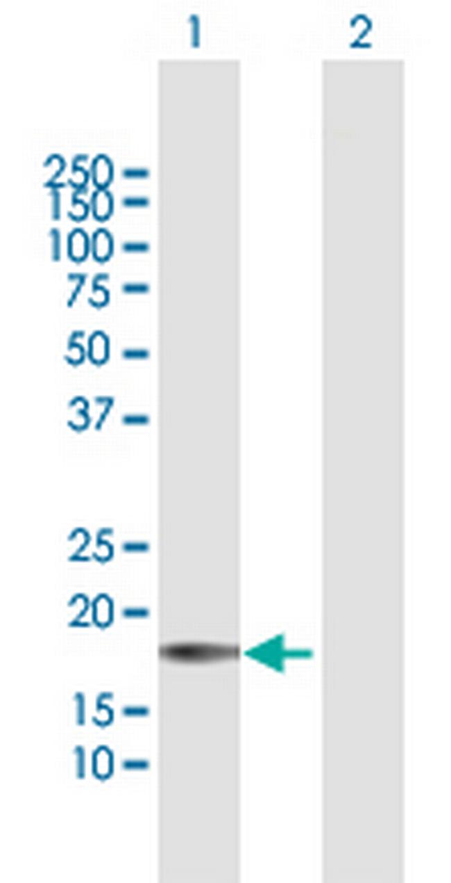 PACAP Antibody in Western Blot (WB)