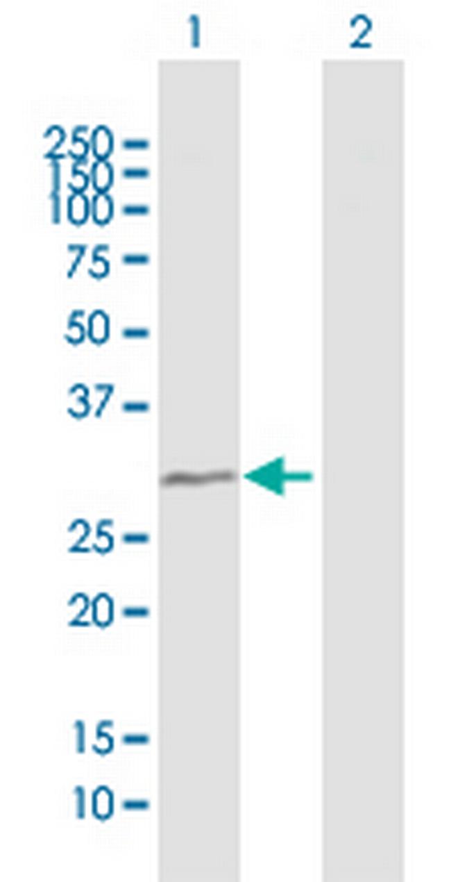 TBC1D7 Antibody in Western Blot (WB)