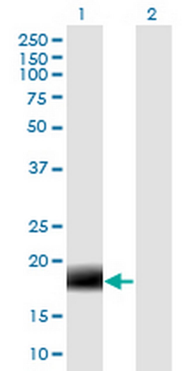 MARCH2 Antibody in Western Blot (WB)