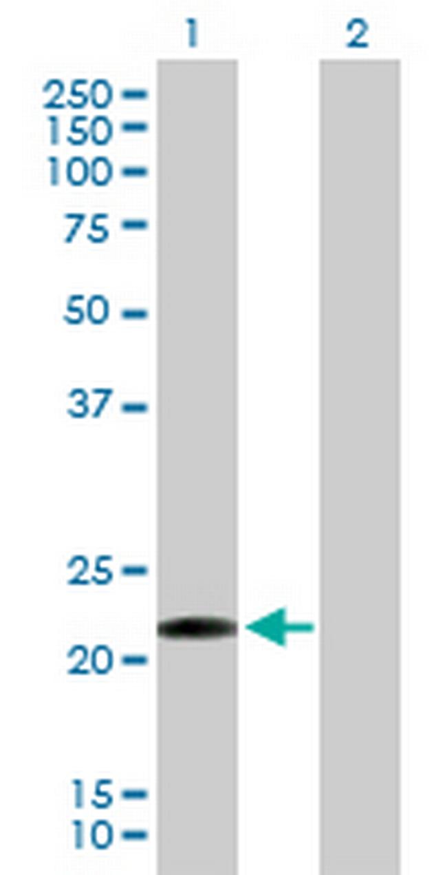 CLEC1B Antibody in Western Blot (WB)