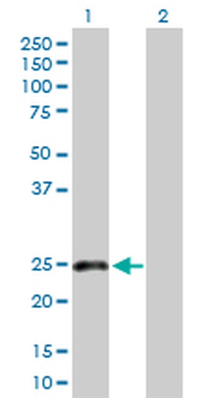 CLEC1B Antibody in Western Blot (WB)