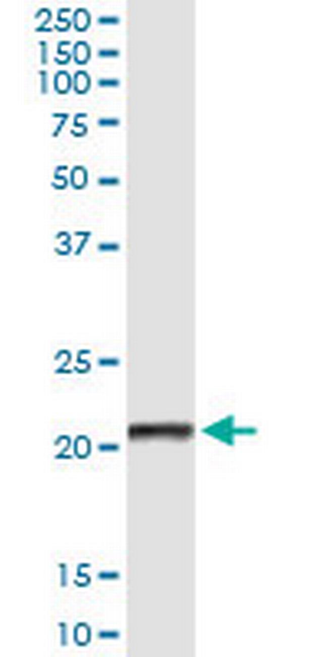 CLEC1B Antibody in Immunoprecipitation (IP)