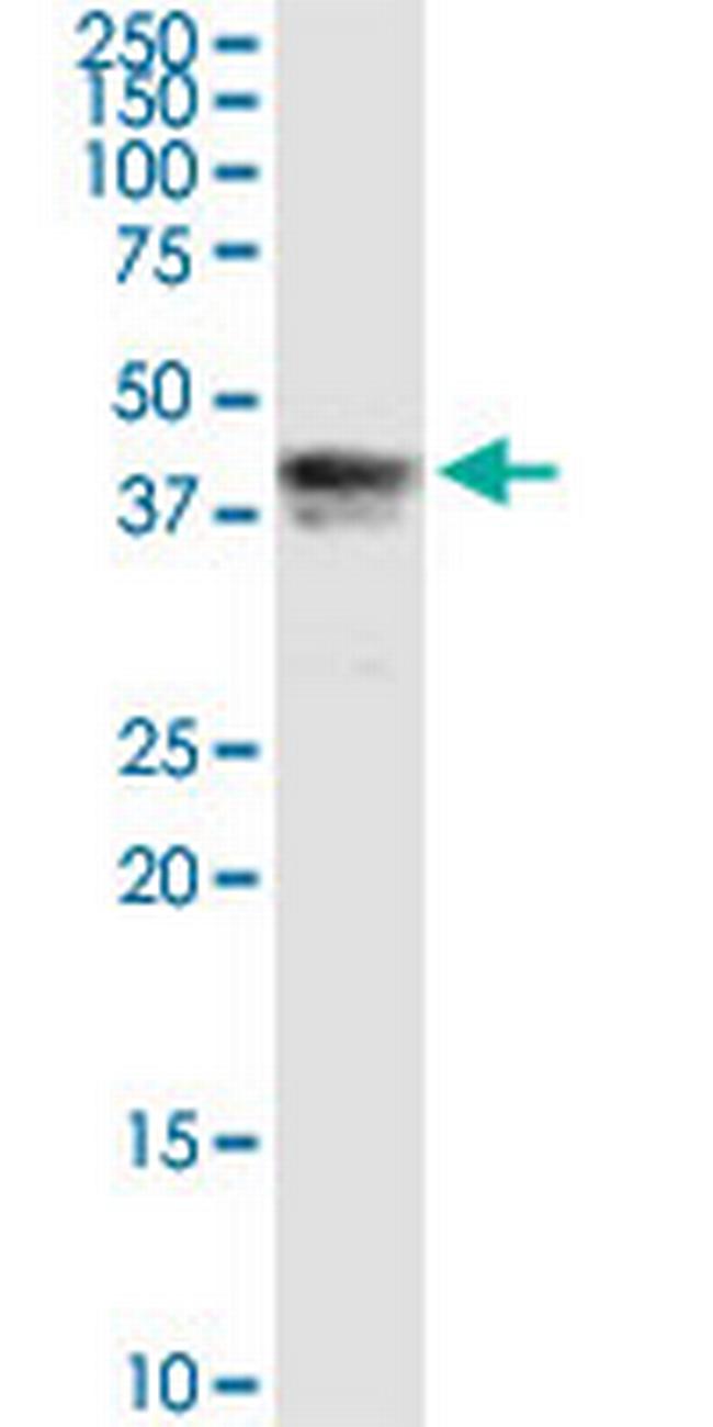 PIPOX Antibody in Western Blot (WB)
