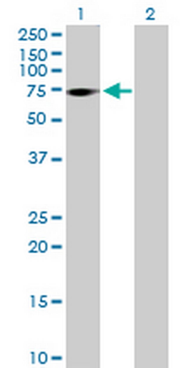 ZNF571 Antibody in Western Blot (WB)