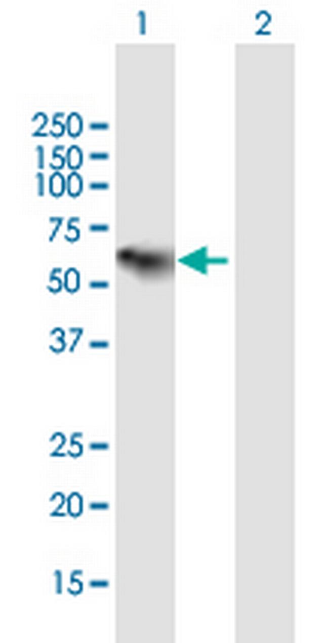 C1RL Antibody in Western Blot (WB)