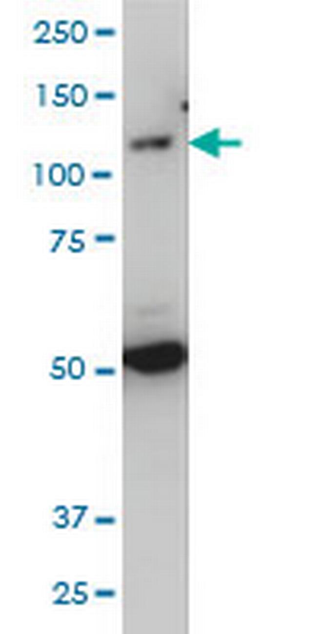 TLR7 Antibody in Western Blot (WB)