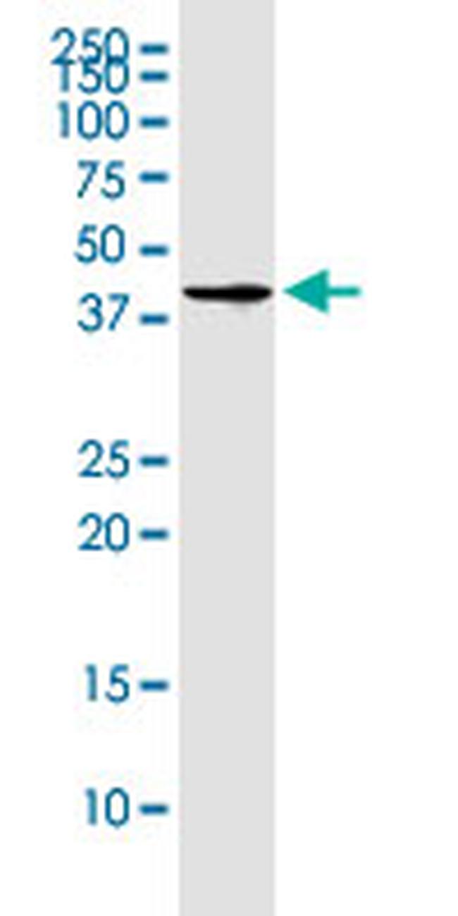 CD320 Antibody in Western Blot (WB)