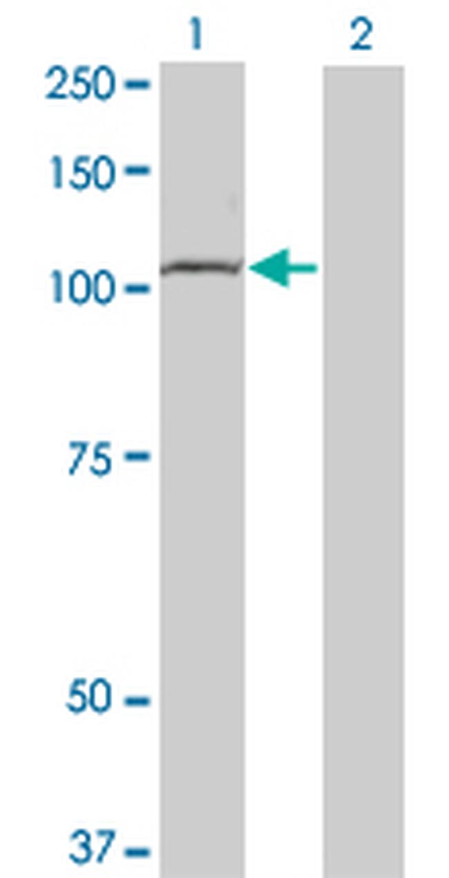 TLR8 Antibody in Western Blot (WB)