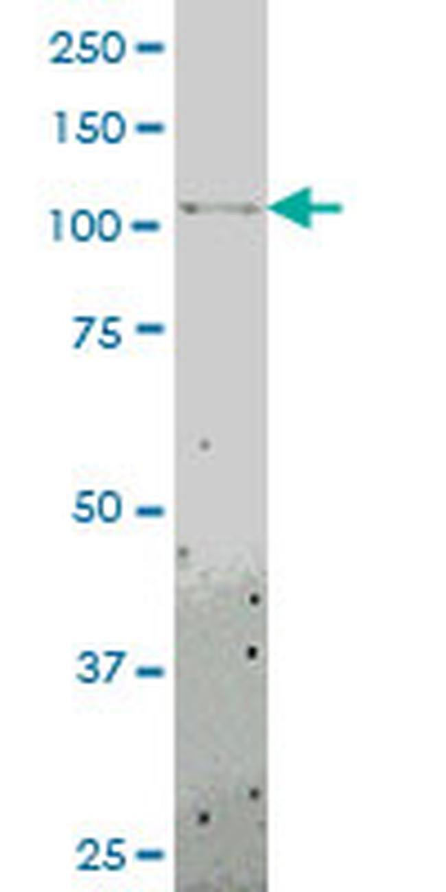 TLR8 Antibody in Western Blot (WB)