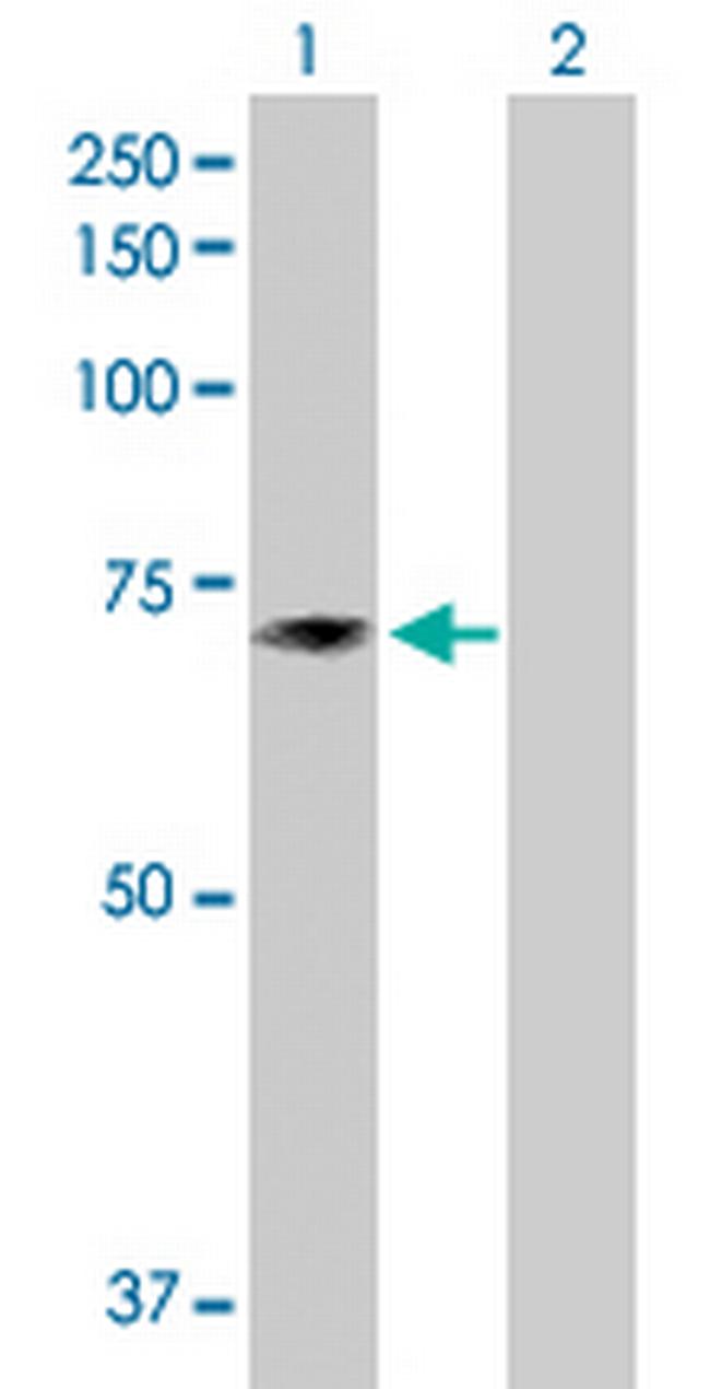 TXNDC3 Antibody in Western Blot (WB)