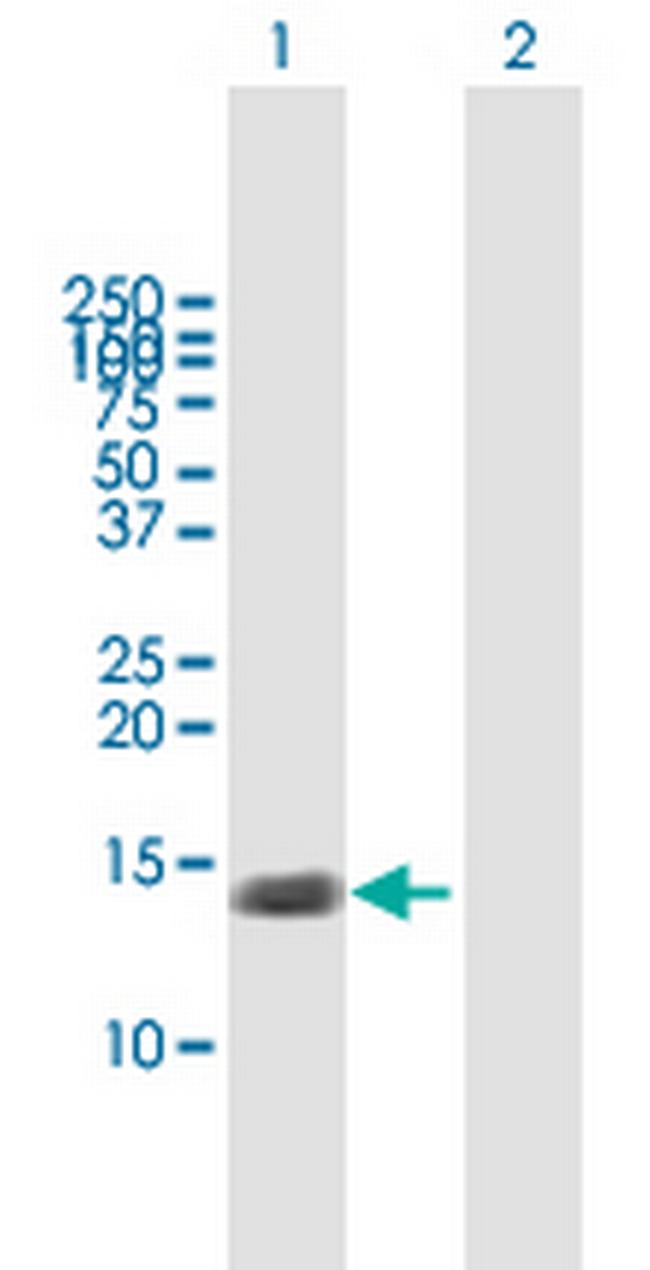 TNFRSF12A Antibody in Western Blot (WB)