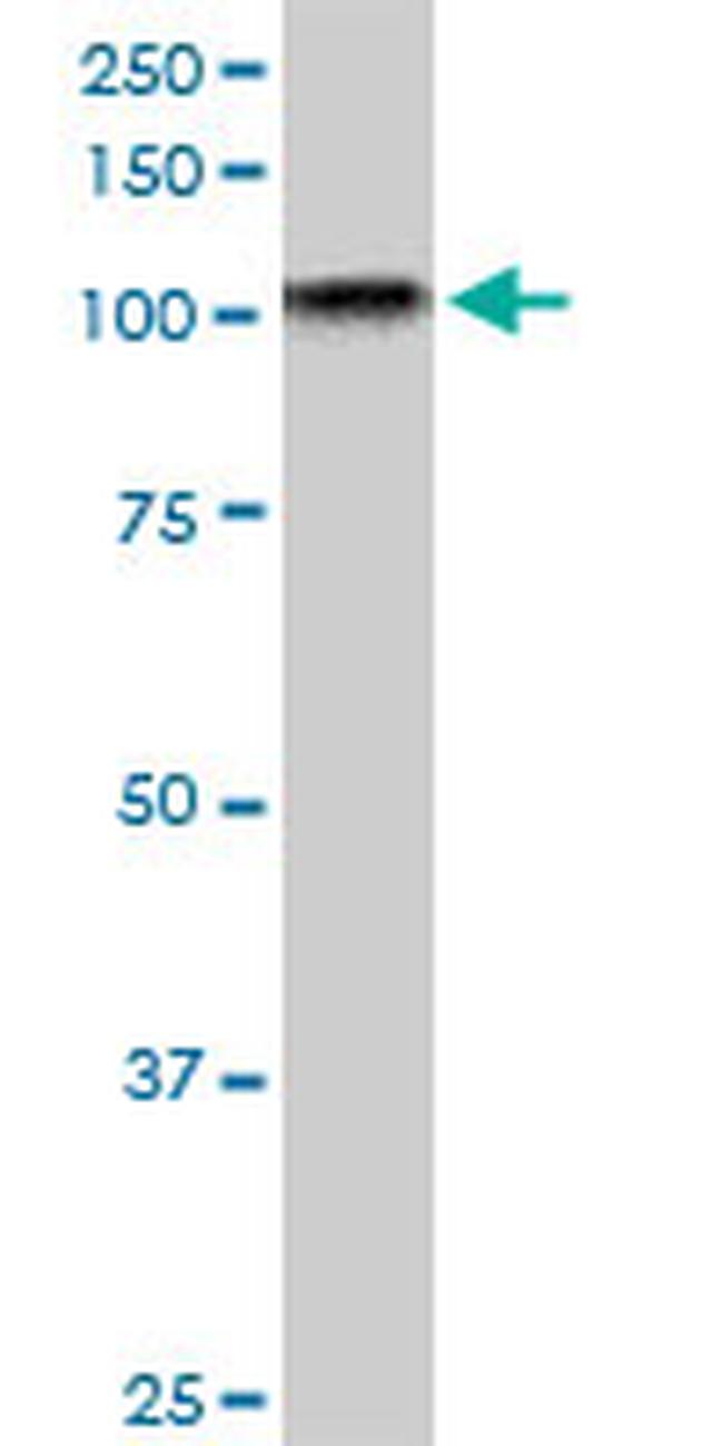 TAOK3 Antibody in Western Blot (WB)