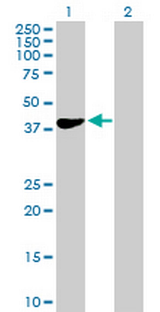 HEMK1 Antibody in Western Blot (WB)