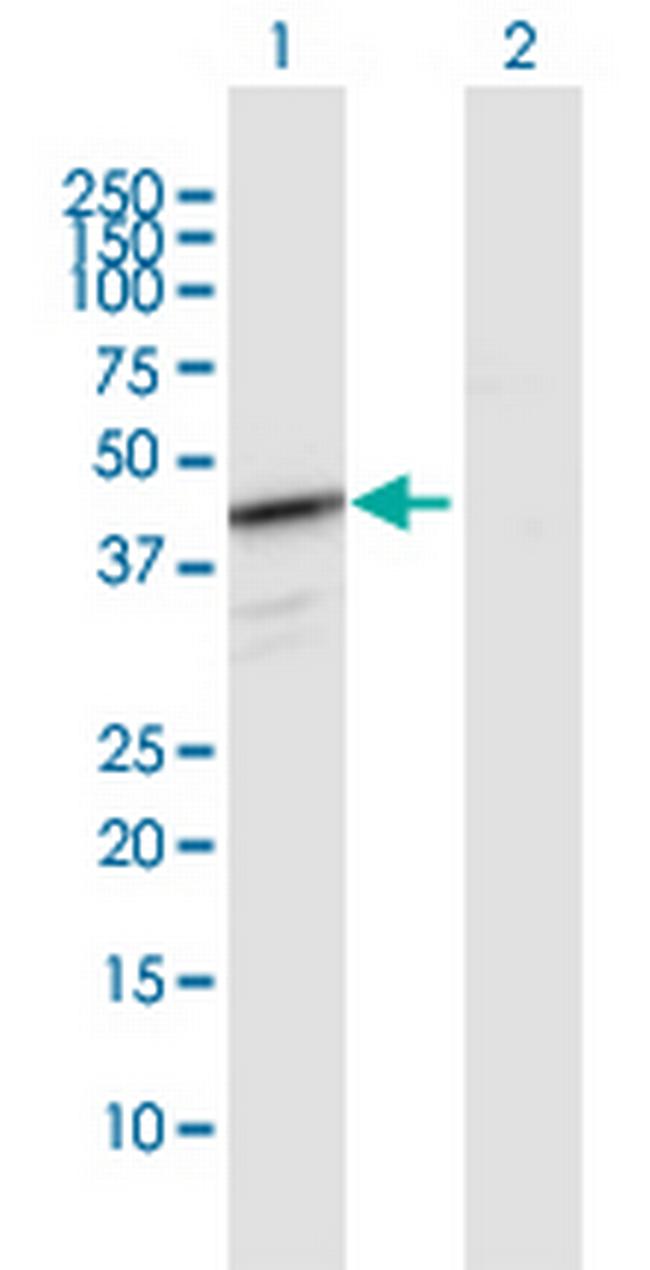 HEMK1 Antibody in Western Blot (WB)