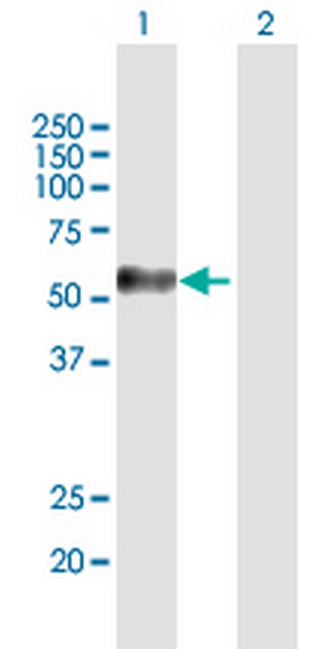 MAGEC2 Antibody in Western Blot (WB)