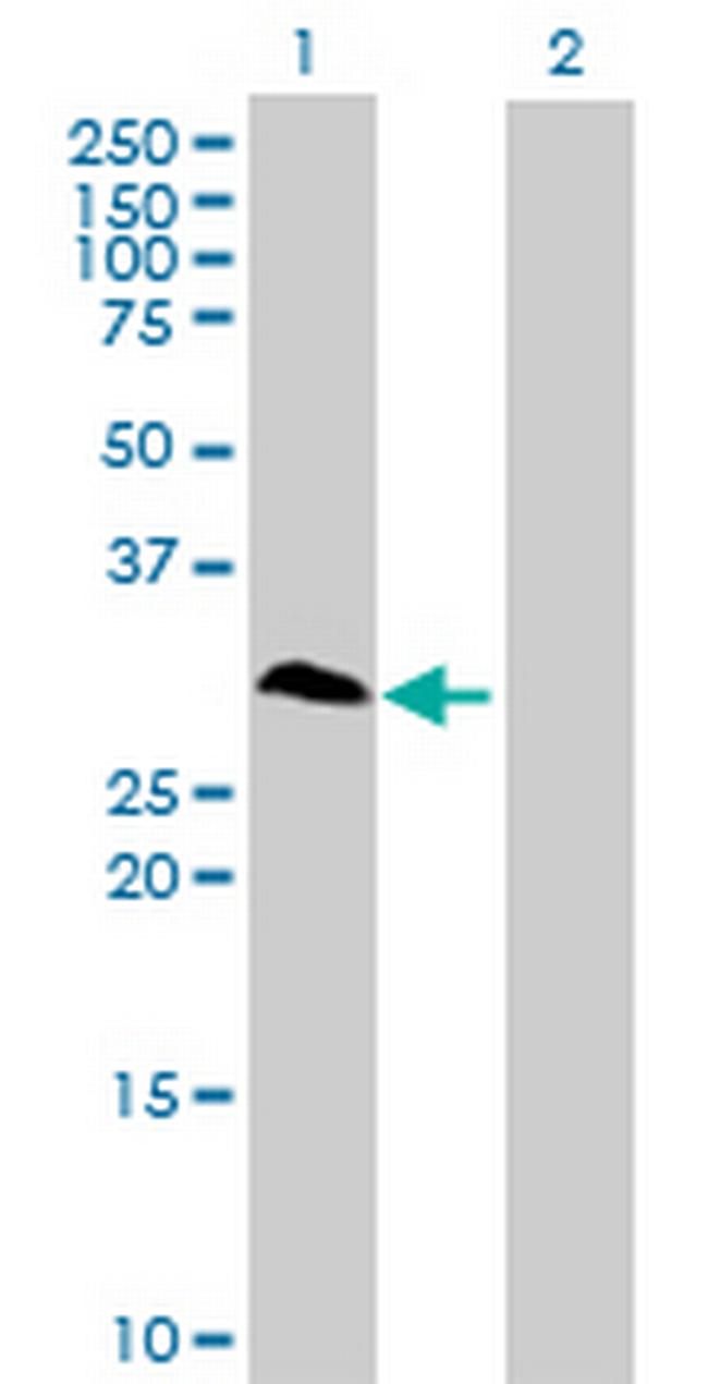 RNF138 Antibody in Western Blot (WB)