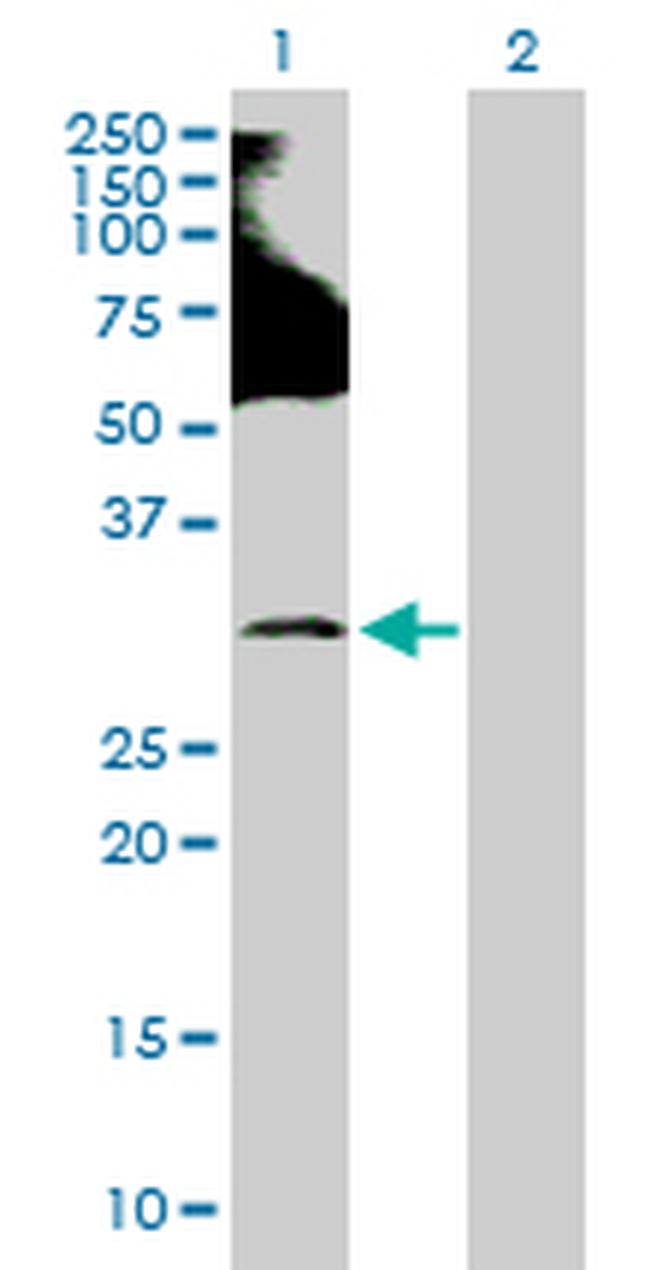 RNF138 Antibody in Western Blot (WB)