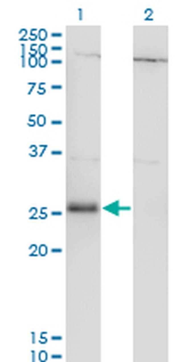 RNF138 Antibody in Western Blot (WB)