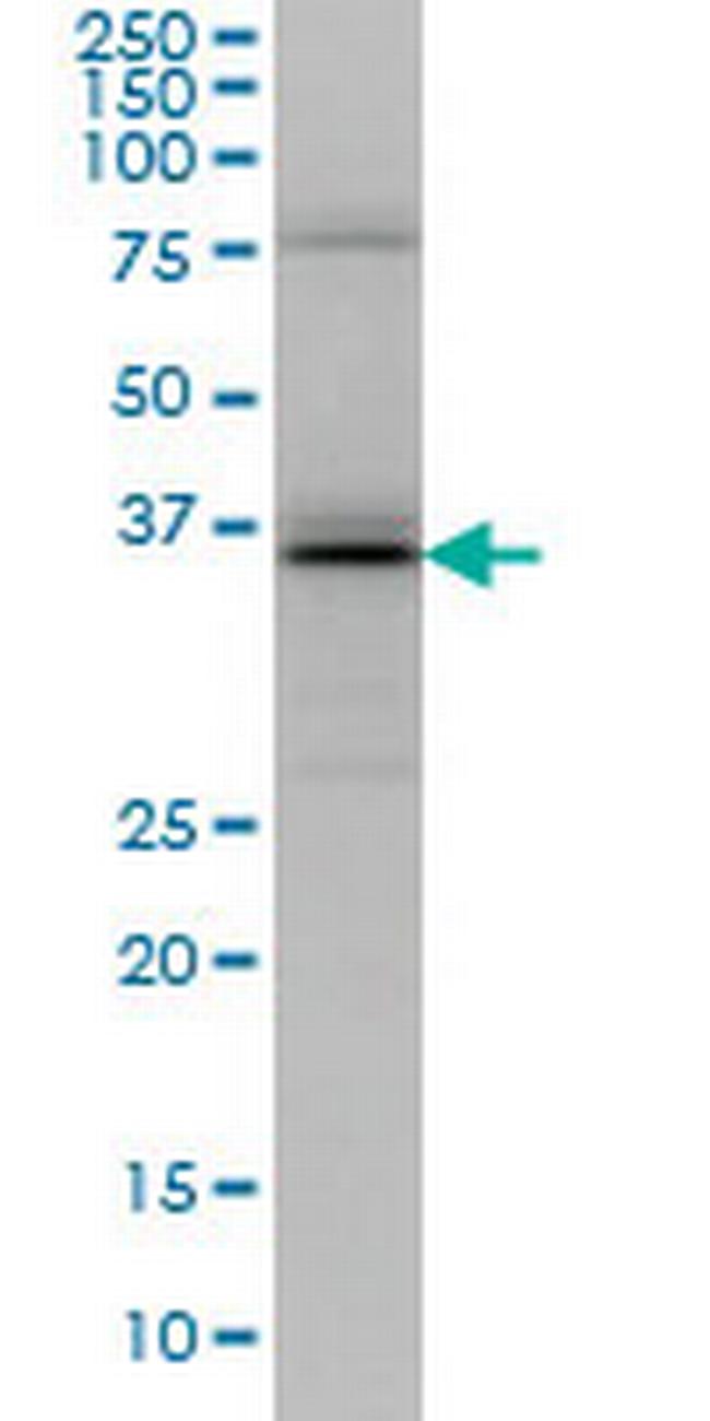 UBE2J1 Antibody in Western Blot (WB)