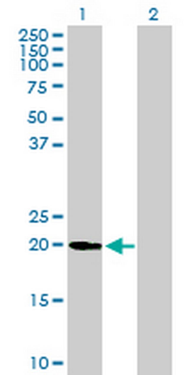 UFC1 Antibody in Western Blot (WB)