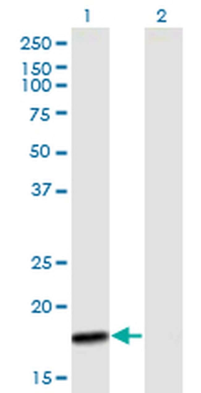 MTP18 Antibody in Western Blot (WB)