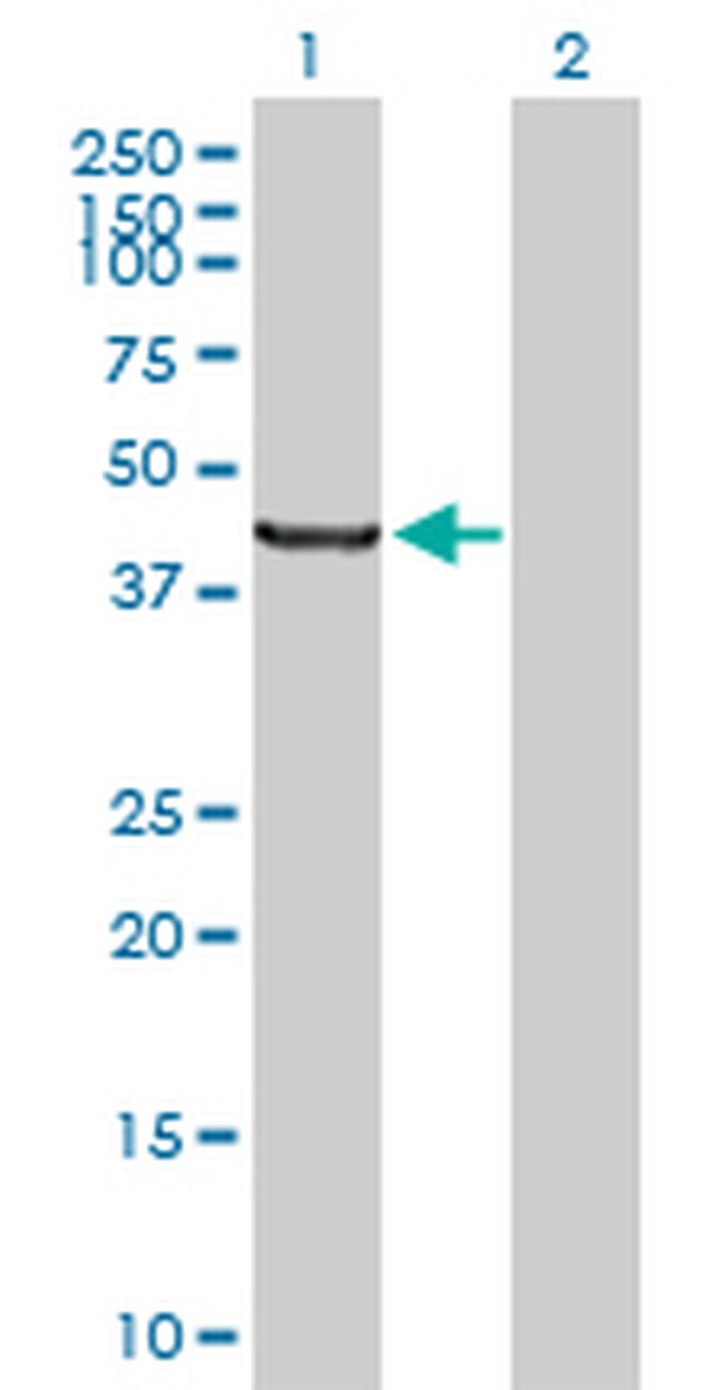 SCLY Antibody in Western Blot (WB)
