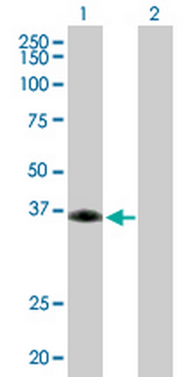 SIRT6 Antibody in Western Blot (WB)