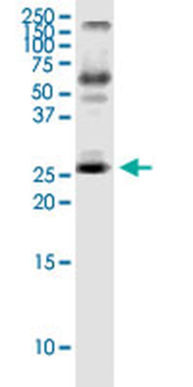 IL23A Antibody in Western Blot (WB)