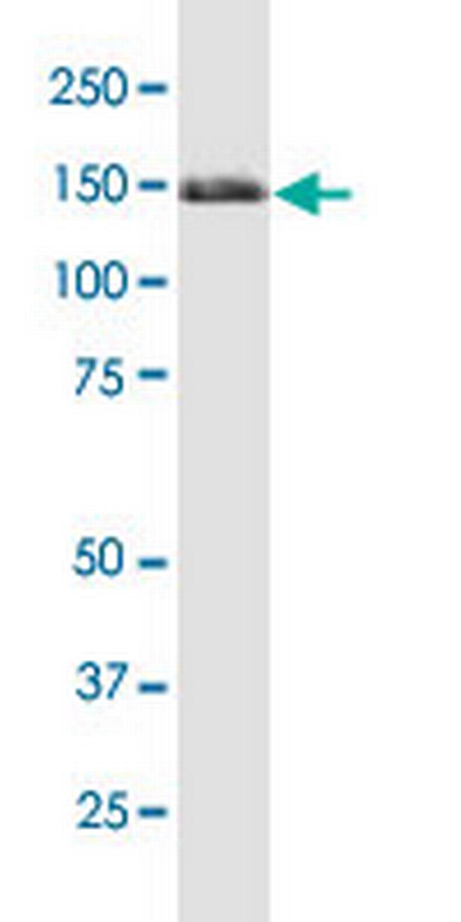 TRIM33 Antibody in Western Blot (WB)