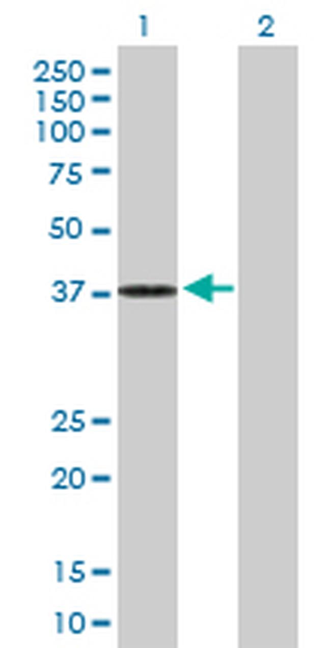 DHRS7 Antibody in Western Blot (WB)
