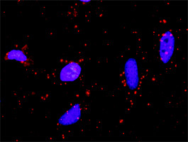 SUFU Antibody in Proximity Ligation Assay (PLA) (PLA)