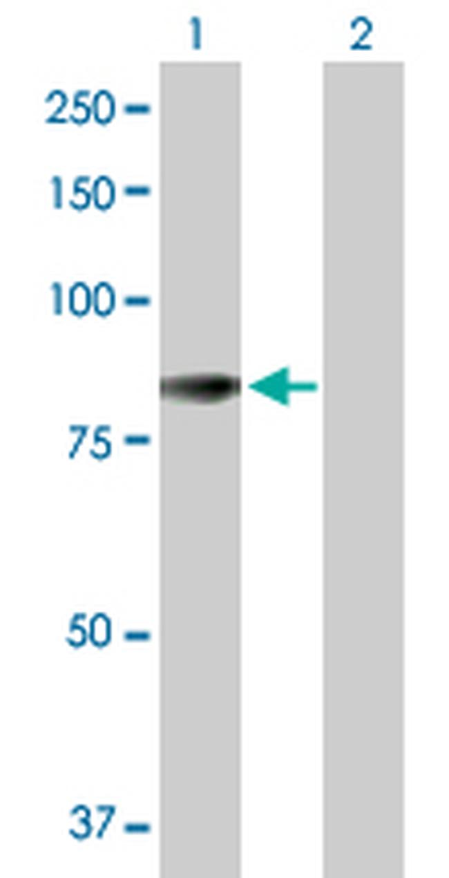 ACSL5 Antibody in Western Blot (WB)