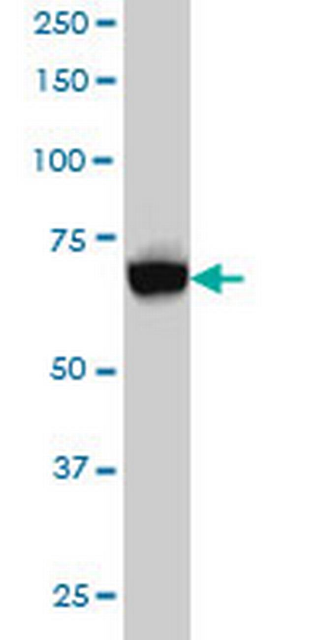 ACSL5 Antibody in Western Blot (WB)