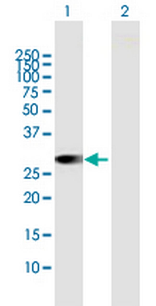 RAB23 Antibody in Western Blot (WB)