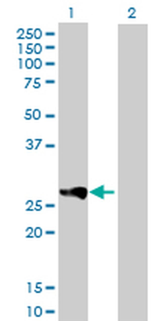 RAB23 Antibody in Western Blot (WB)