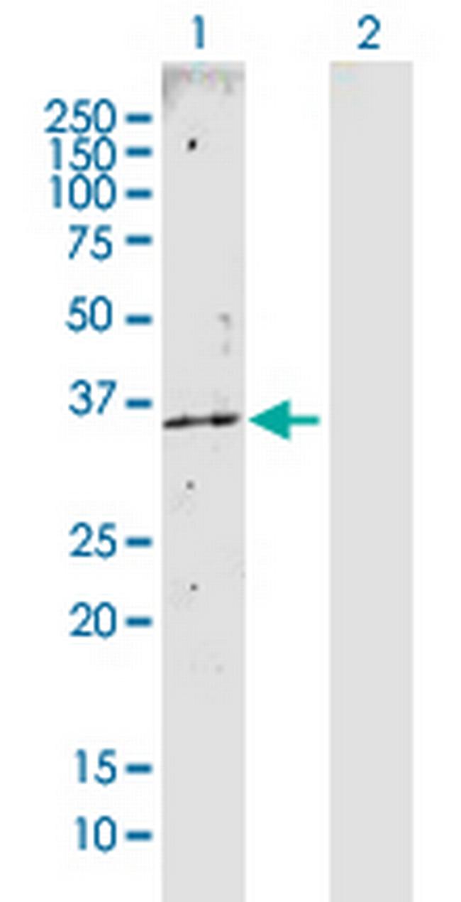 CAB39 Antibody in Western Blot (WB)