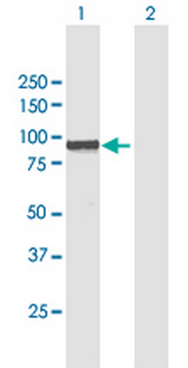 WBP11 Antibody in Western Blot (WB)