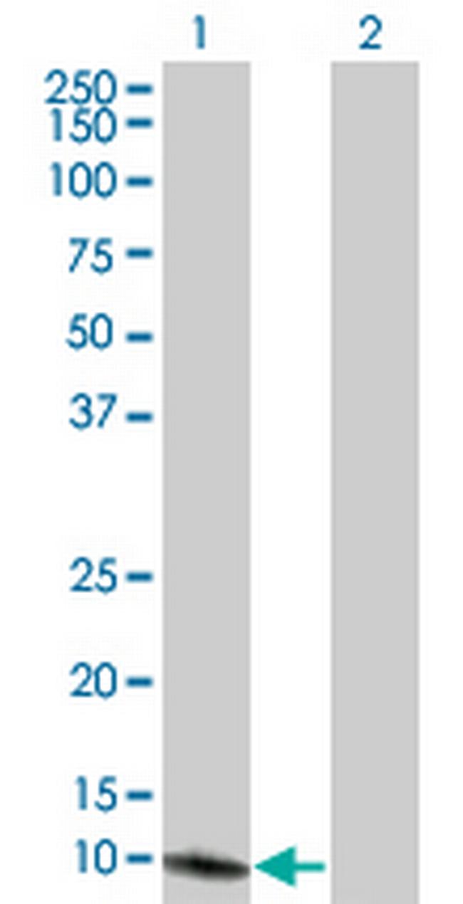 SEPX1 Antibody in Western Blot (WB)