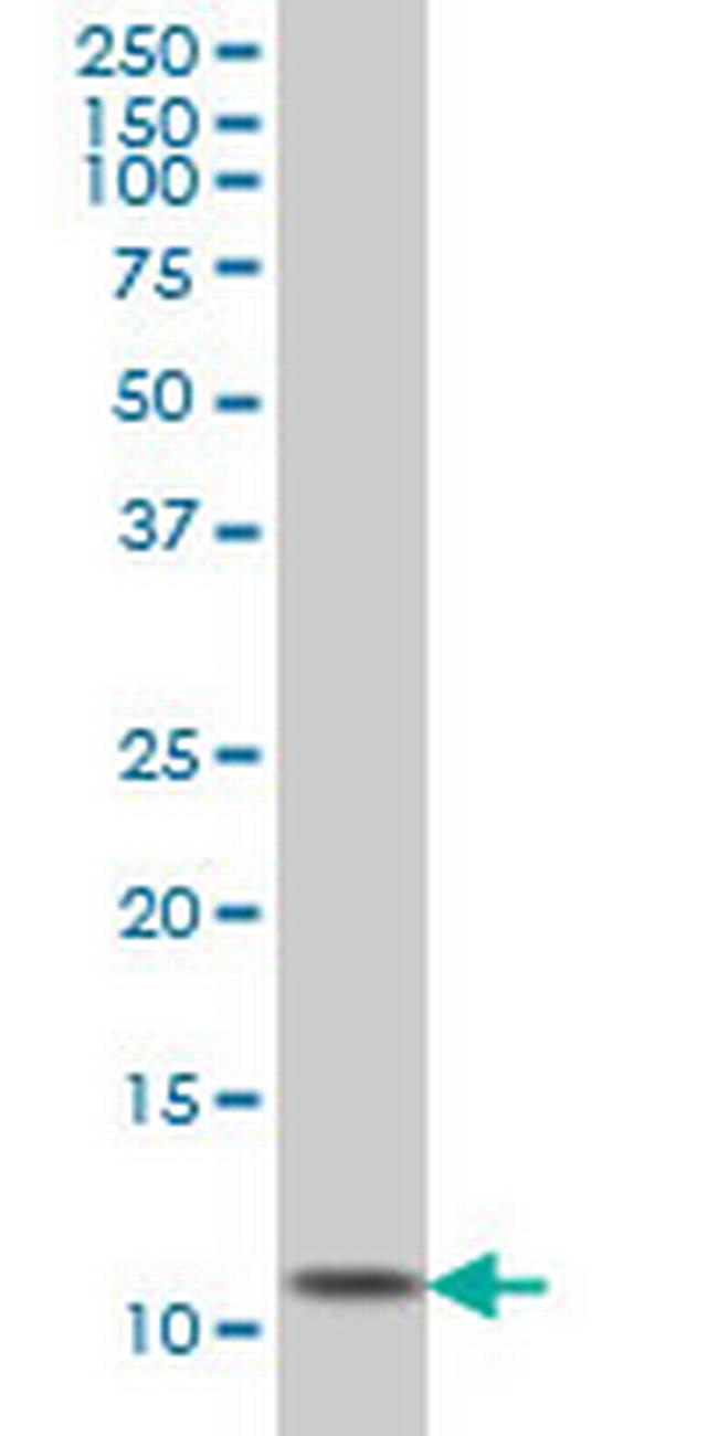 GHRL Antibody in Western Blot (WB)