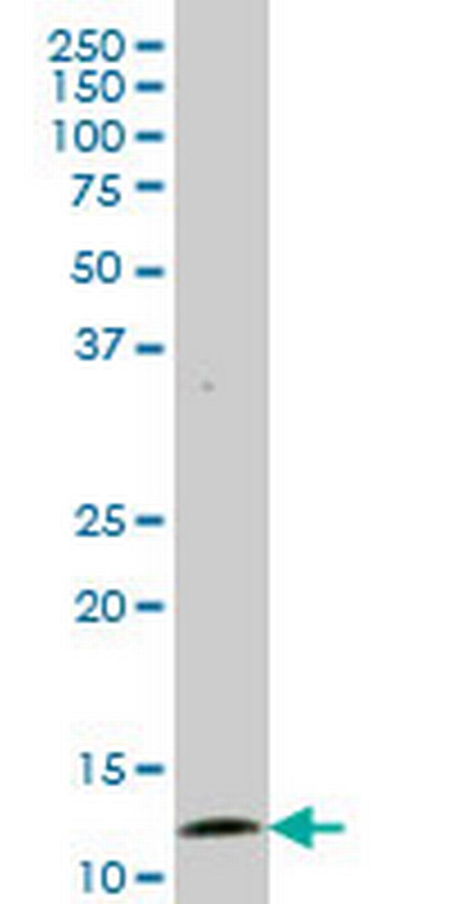 GHRL Antibody in Western Blot (WB)